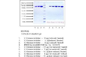 Gel Scan of C1 Esterase Inhibitor, Human Plasma  This information is representative of the product ART prepares, but is not lot specific. (SERPING1 Protein)