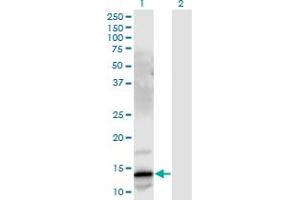 Western Blot analysis of GRP expression in transfected 293T cell line by GRP monoclonal antibody (M03), clone 3A11. (Gastrin-Releasing Peptide Antikörper  (AA 1-148))