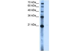 WB Suggested Anti-OLR1 Antibody Titration:  2. (OLR1 Antikörper  (N-Term))