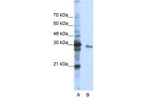 EXOSC3 antibody used at 1 ug/ml to detect target protein. (EXOSC3 Antikörper  (Middle Region))