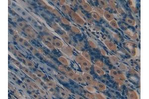 Immunohistochemistry (IHC) image for anti-Matrix Metallopeptidase 12 (Macrophage Elastase) (MMP12) (AA 294-473) antibody (ABIN7431752)