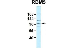 Human HepG2 (RBM5 Antikörper  (N-Term))