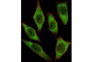 Fluorescent image of A549 cell stained with RT Antibody (N-term) 2893a/SA091009AF. (APRT Antikörper  (N-Term))