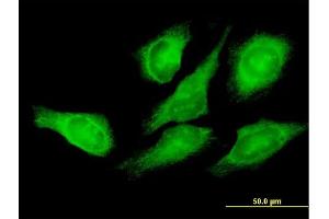 Immunofluorescence of purified MaxPab antibody to EEF1G on HeLa cell. (EEF1G Antikörper  (AA 1-437))
