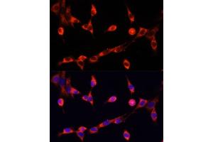 Immunofluorescence analysis of NIH/3T3 cells using CHAT antibody (ABIN6131569, ABIN6138488, ABIN6138490 and ABIN6217173) at dilution of 1:100. (Choline Acetyltransferase Antikörper  (AA 331-630))