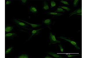 Immunofluorescence (IF) image for anti-Protein Phosphatase 2, Catalytic Subunit, beta Isozyme (PPP2CB) (AA 1-309) antibody (ABIN948302)