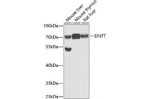 Western blot analysis of extracts of various cell lines using DNTT Polyclonal Antibody at dilution of 1:1000. (TdT Antikörper)