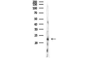 Western blot analysis of lysates from Rat liver, using ARL4D Antibody at 1/1000 dilution.