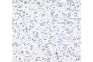 Immunohistochemistry (IHC) image for anti-Proprotein Convertase Subtilisin/kexin Type 2 (PCSK2) (AA 150-200) antibody (ABIN7454823)