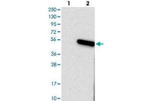 Western blot analysis of Lane 1: Negative control (vector only transfected HEK293T lysate), Lane 2: Over-expression Lysate (Co-expressed with a C-terminal myc-DDK tag (~3. (TMEM130 Antikörper)