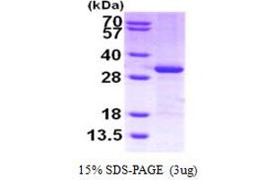 SDS-PAGE (SDS) image for Cbp/p300-Interacting Transactivator, with Glu/Asp-Rich Carboxy-terminal Domain, 2 (CITED2) (AA 1-270) protein (His tag) (ABIN666771) (CITED2 Protein (AA 1-270) (His tag))