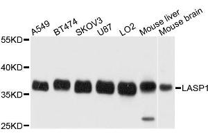 Western blot analysis of extracts of various cell lines, using LASP1 antibody. (LASP1 Antikörper  (AA 130-205))