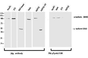 Western Blotting (WB) image for anti-Phosphoinositide 3 Kinase, p85 alpha/gamma (PI3K p85a/g) (pTyr199), (pTyr467) antibody (ABIN5956305) (PI3K p85 alpha/gamma Antikörper  (pTyr199, pTyr467))