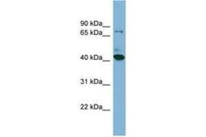 Image no. 1 for anti-HERPUD Family Member 2 (HERPUD2) (N-Term) antibody (ABIN6742038) (HERPUD2 Antikörper  (N-Term))