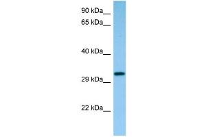 WB Suggested Anti-Capzb Antibody Titration: 1. (CAPZB Antikörper  (C-Term))
