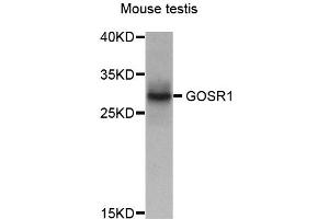 Western blot analysis of extract of various cells, using GOSR1 antibody. (GS28 Antikörper)
