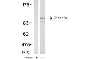 Image no. 1 for anti-Catenin (Cadherin-Associated Protein), beta 1, 88kDa (CTNNB1) (Tyr654) antibody (ABIN319393) (CTNNB1 Antikörper  (Tyr654))
