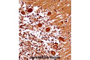 Immunohistochemistry (IHC) image for anti-Mesenchyme Homeobox 1 (MEOX1) antibody (ABIN2998080)