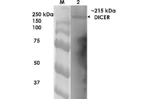 Western Blot analysis of Rat Brain Membrane showing detection of ~215 kDa Dicer protein using Mouse Anti-Dicer Monoclonal Antibody, Clone S167-7 . (DICER1 Antikörper  (AA 1638-1899) (Atto 390))