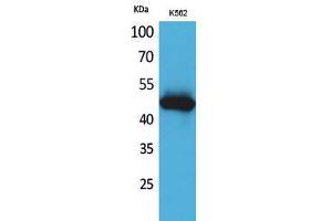 Western Blotting (WB) image for anti-Interleukin 5 Receptor, alpha (IL5RA) (N-Term) antibody (ABIN3178245) (IL5RA Antikörper  (N-Term))
