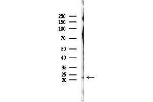 anti-Mitochondrial Ribosomal Protein S11 (MRPS11) (C-Term) antibody