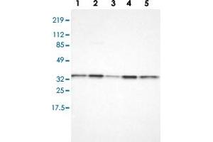 Western blot analysis of Lane 1: RT-4, Lane 2: U-251 MG, Lane 3: A-431, Lane 4: Liver, Lane 5: Tonsil with CYB5R3 polyclonal antibody  at 1:100-1:250 dilution. (CYB5R3 Antikörper)