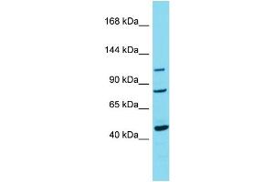Host:  Rabbit  Target Name:  TRPC7  Sample Type:  Breast Tumor lysates  Antibody Dilution:  1. (TRPC7 Antikörper  (C-Term))