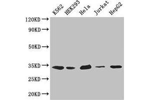 Western Blot Positive WB detected in: K562 whole cell lysate, HEK293 whole cell lysate, Hela whole cell lysate, Jurkat whole cell lysate, HepG2 whole cell lysate All lanes: CDK2 antibody at 2. (CDK2 Antikörper  (AA 1-298))