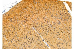 ABIN6263422 and ABIN6276330 at 1/100 staining Mouse brain tissue by IHC-P. (MTM1 Antikörper  (C-Term))