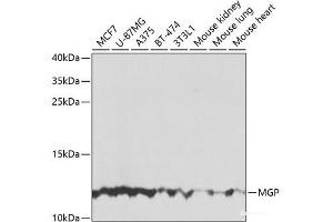 Western blot analysis of extracts of various cell lines using MGP Polyclonal Antibody at dilution of 1:1000. (MGP Antikörper)