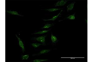 Immunofluorescence of purified MaxPab antibody to MINA on HeLa cell.