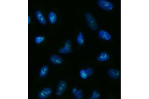 IF analysis of TOX2 using anti-TOX2 antibody (ABIN7601667).