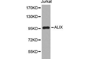 Western blot analysis of extracts of Jurkat cell line, using ALIX antibody. (ALIX Antikörper  (AA 1-180))