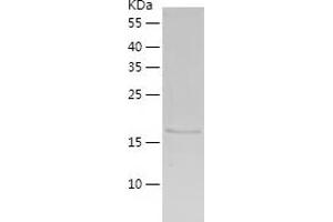 Western Blotting (WB) image for Chromodomain Helicase DNA Binding Protein 2 (CHD2) (AA 260-456) protein (His tag) (ABIN7122368) (CHD2 Protein (AA 260-456) (His tag))