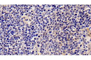 Detection of IL2Ra in Porcine Spleen Tissue using Polyclonal Antibody to Interleukin 2 Receptor Alpha (IL2Ra) (CD25 Antikörper  (AA 22-245))