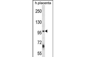 Western Blotting (WB) image for anti-Zinc Finger, FYVE Domain Containing 1 (ZFYVE1) (AA 145-173), (N-Term) antibody (ABIN656392)