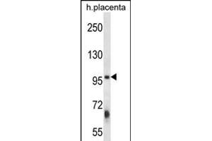 ZFYVE1 Antibody (N-term) (ABIN656392 and ABIN2845686) western blot analysis in human placenta tissue lysates (35 μg/lane). (ZFYVE1 Antikörper  (N-Term))