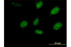 Immunofluorescence of purified MaxPab antibody to PEPP-2 on HeLa cell. (RHOXF2 Antikörper  (AA 1-288))
