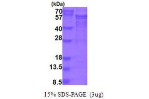 SDS-PAGE (SDS) image for Protein Interacting With Protein Kinase C, alpha 1 (PICK1) (AA 1-415) protein (His tag) (ABIN5854029)
