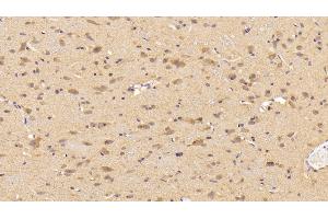 Immunohistochemistry (IHC) image for anti-Tyrosine Hydroxylase (TH) (AA 34-301) antibody (ABIN7433639)