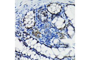 Immunohistochemistry of paraffin-embedded mouse colon using S Rabbit mAb (ABIN7270152) at dilution of 1:100 (40x lens). (SATB2 Antikörper)