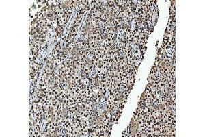 IHC analysis of hnRNP L/HNRNPL using anti-hnRNP L/HNRNPL antibody (ABIN7600130). (HNRNPL Antikörper  (AA 152-569))