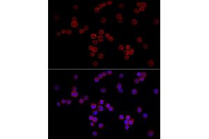 Immunofluorescence (IF) image for anti-Nuclear Factor of Activated T-Cells, Cytoplasmic, Calcineurin-Dependent 3 (NFATC3) (AA 1-290) antibody (ABIN6144558)