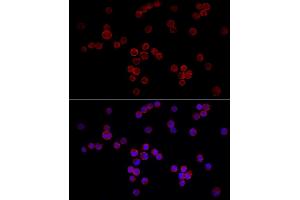 Immunofluorescence analysis of K-562 cells using NF Rabbit pAb (ABIN6130595, ABIN6144558, ABIN6144559 and ABIN6222368) at dilution of 1:50 (40x lens).