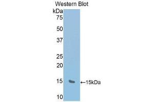 Western Blotting (WB) image for anti-RalA Binding Protein 1 (RALBP1) (AA 527-626) antibody (ABIN1176613) (RALBP1 Antikörper  (AA 527-626))