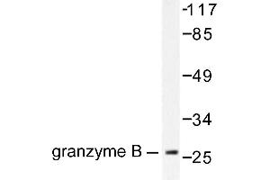 Image no. 1 for anti-Granzyme B (GZMB) antibody (ABIN265445) (GZMB Antikörper)