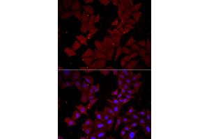 Immunofluorescence analysis of HeLa cells using CCT4 antibody (ABIN5973931). (CCT4 Antikörper)