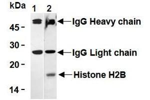 Western Blotting (WB) image for anti-Histone H2B antibody (ABIN1107547) (Histone H2B Antikörper)