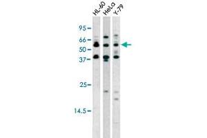 The RAD9A (phospho S272) polyclonal antibody  is used in Western blot to detect Phospho-RAD9A-S272 in HL-60 (left), Hela (middle), and Y-79 (right) cell lysates.