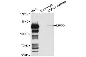 Immunoprecipitation analysis of 150ug extracts of 293T cells using 3ug ERCC4 antibody.